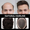 Generisk hårsystem for menn toupee fin mono hårstykke europeisk menneskehår erstatning npu hud rundt toupee for menn (5# middels lysebrun, 8x10 ""-120% middels lys til middels tetthet)